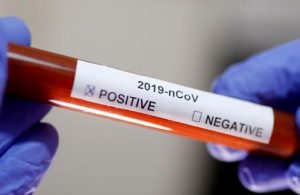 В Мирнограде находятся трое пациентов с подозрением на Covid-19